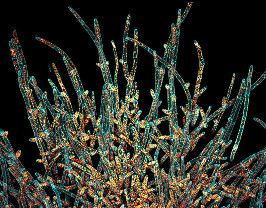 фото мха через микроскоп